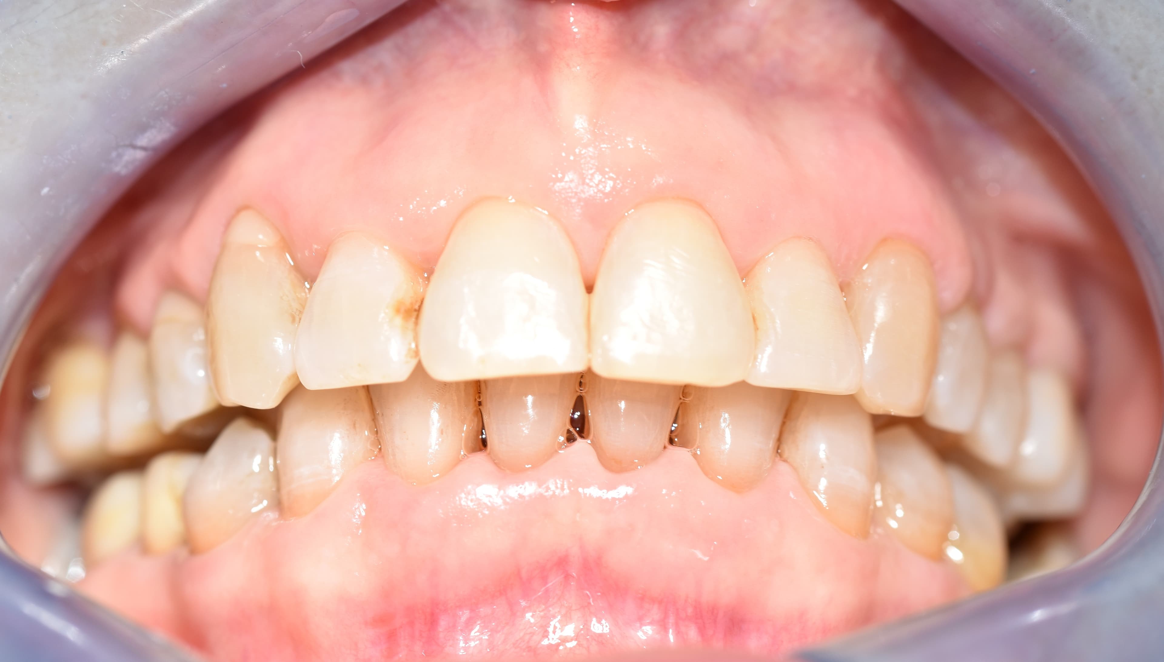 Orthodontics