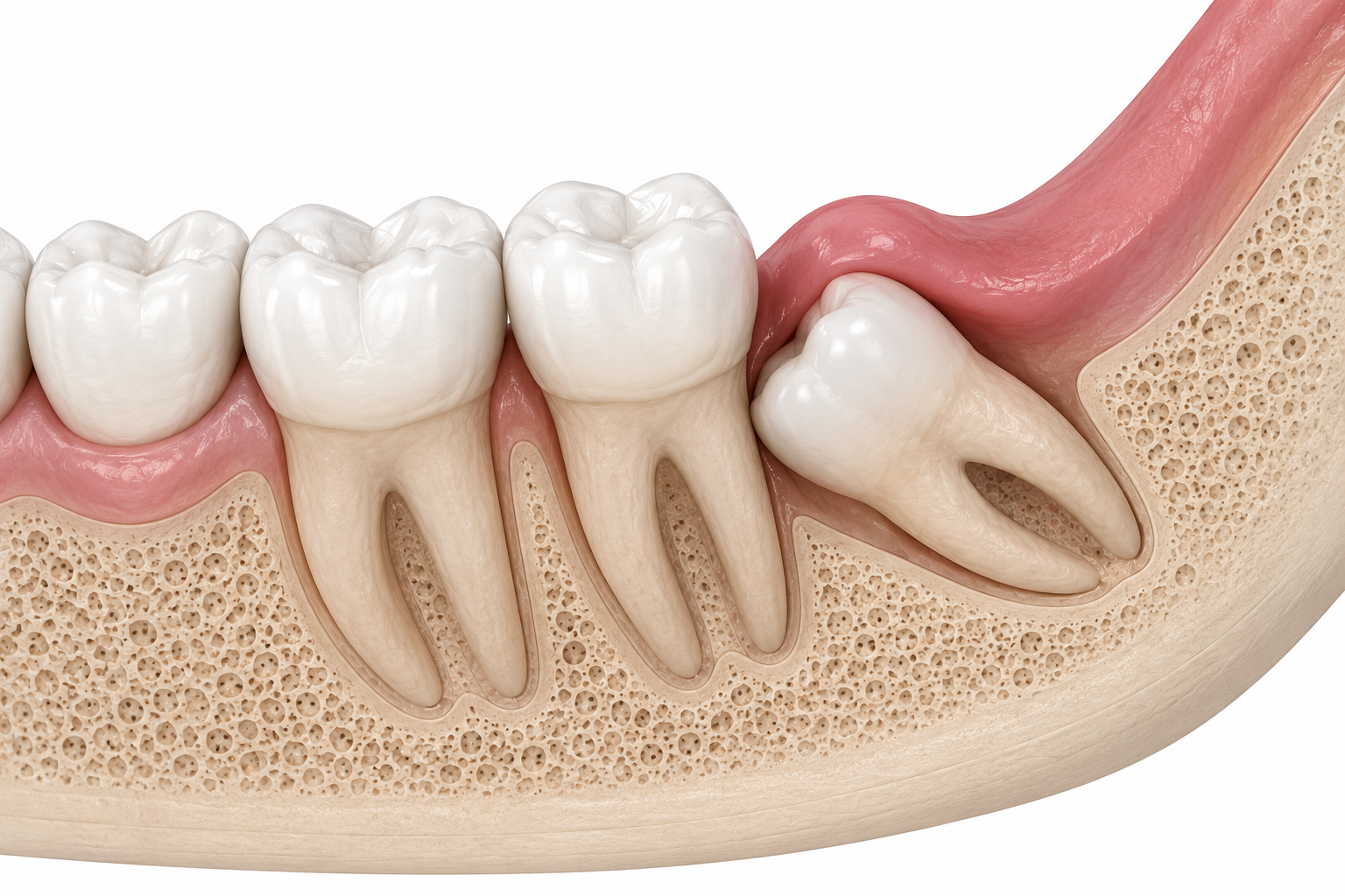 Wisdom tooth consultation using imaging and space assessment